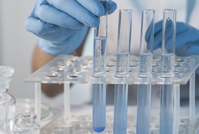 Laboratorijske usluge